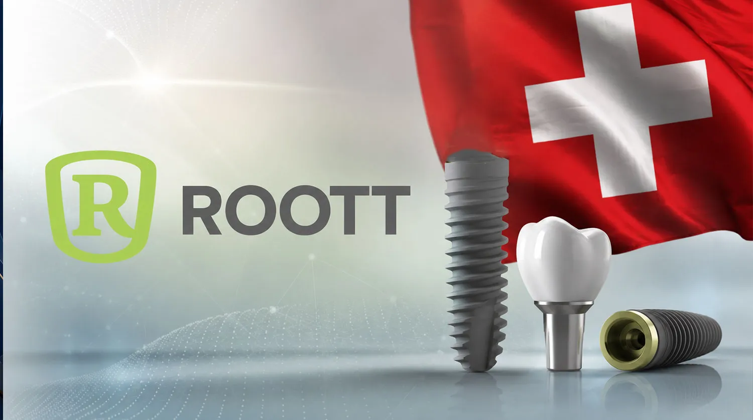ایمپلنت روت roott implant