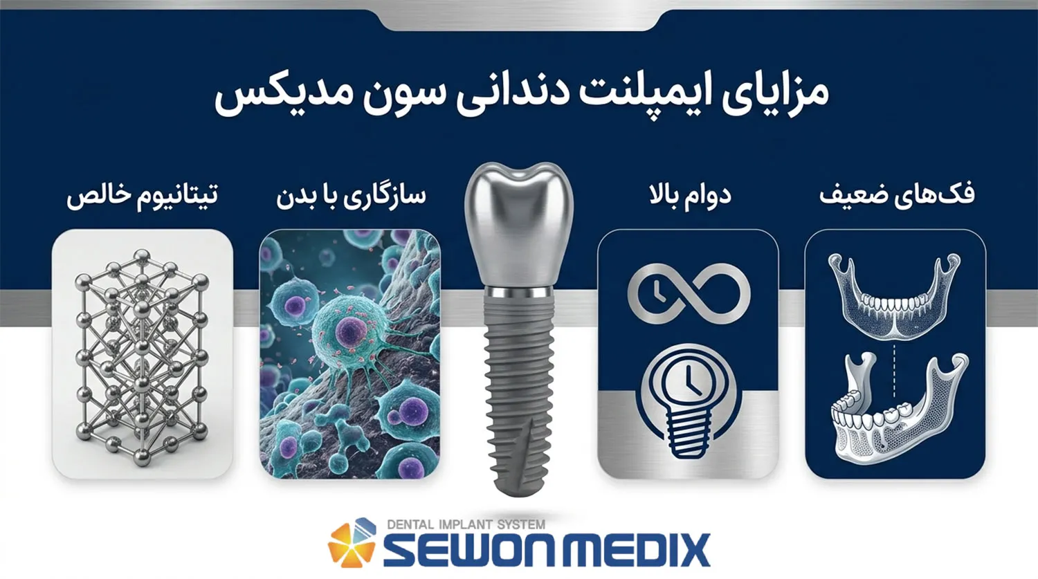 مزایای ایمپلنت کره ای سوون مدیکس sewon medix implant advantages