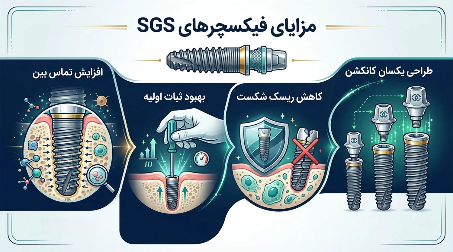 مزایا فیکسچر امیپلنت اس جی اس sgs fixture advantages