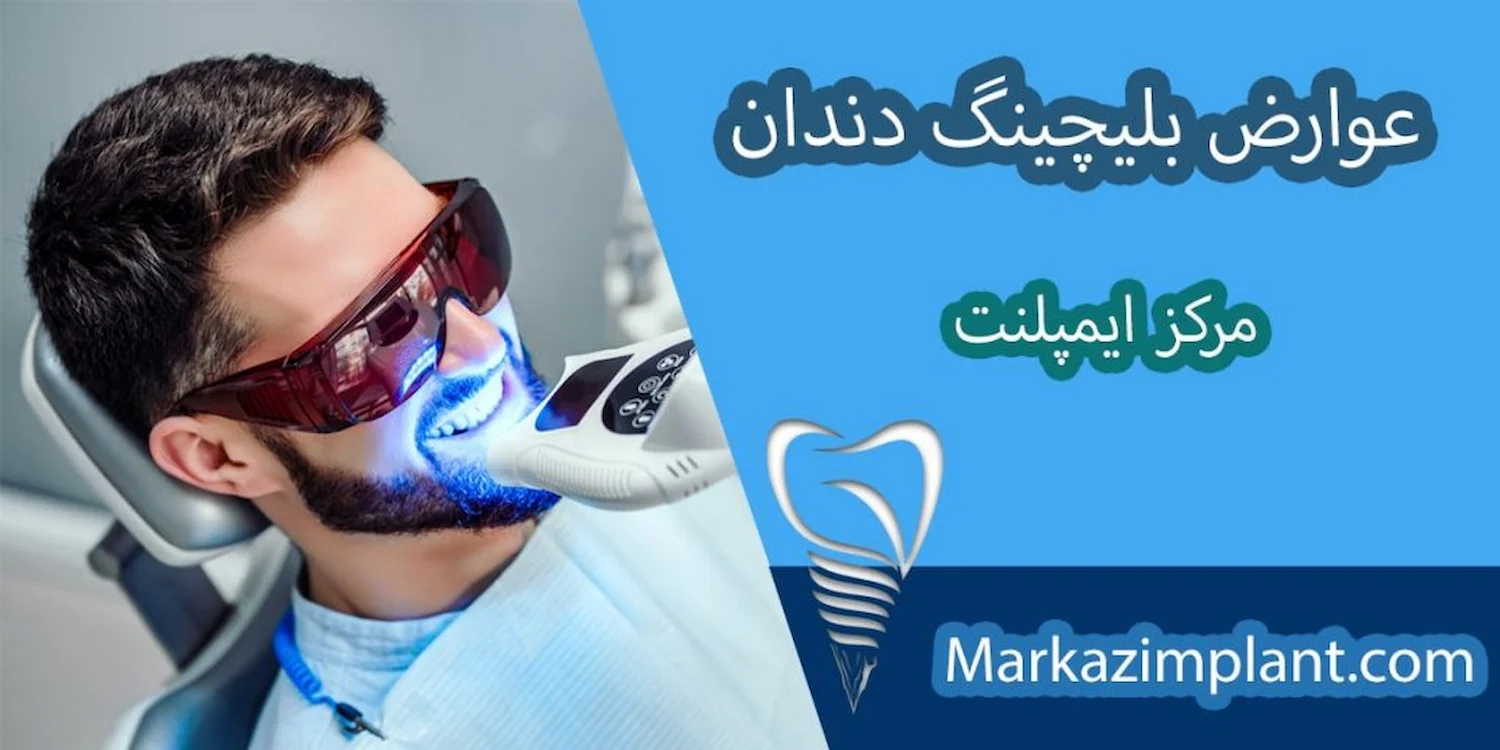 کاهش عوارض بلیچینگ دندان