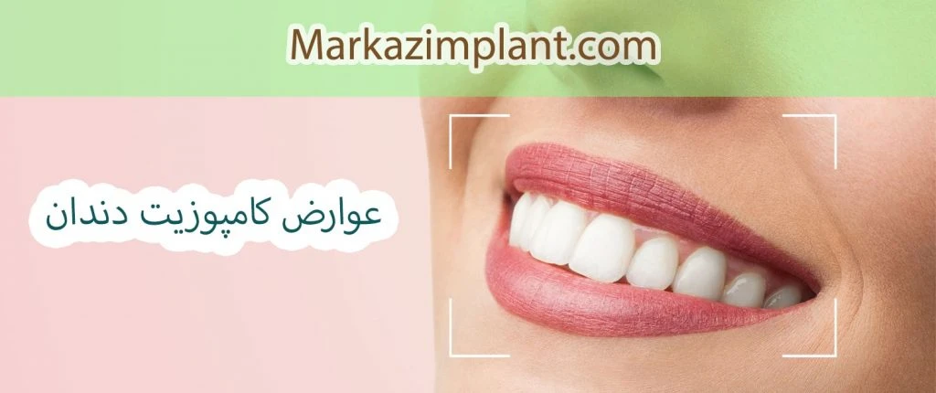 dental composite side effect عوارض کامپوزیت دندان