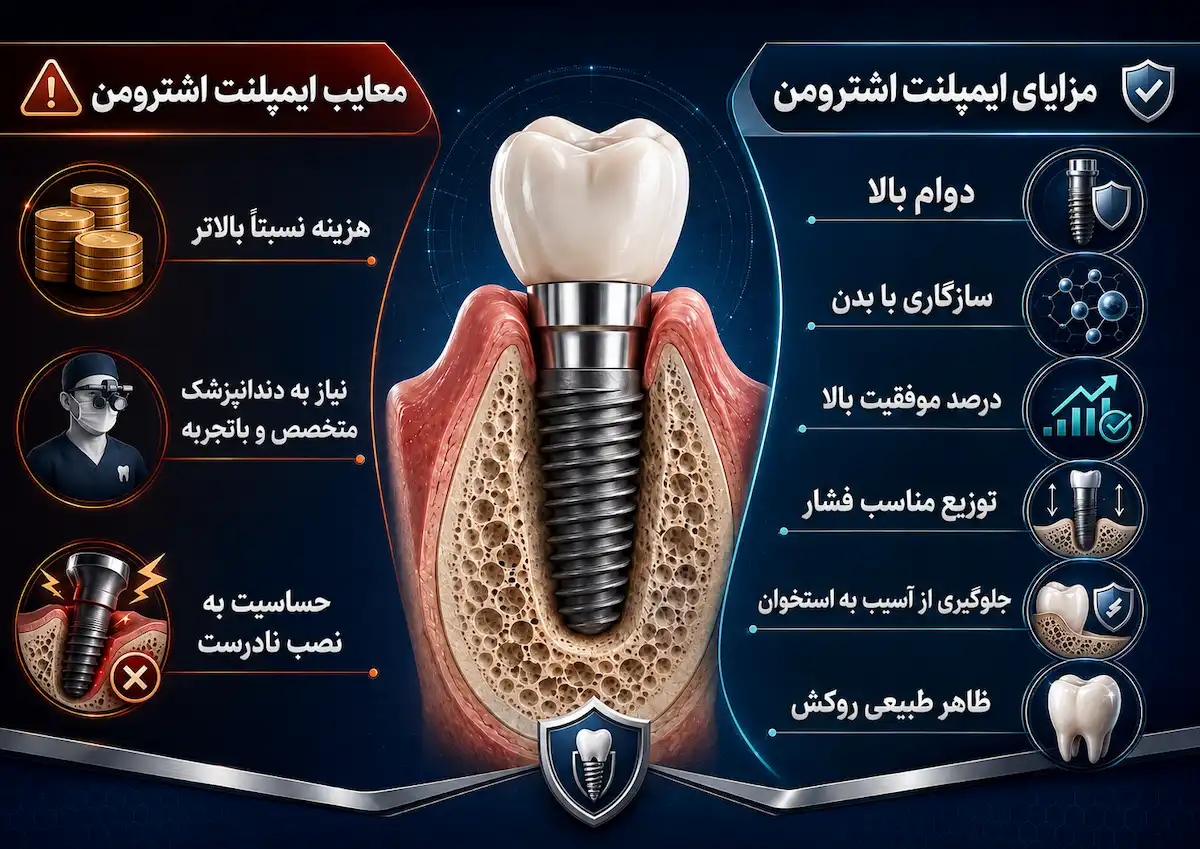 مزایا و معایب ایمپلنت اشترومن straumann implant pros cons