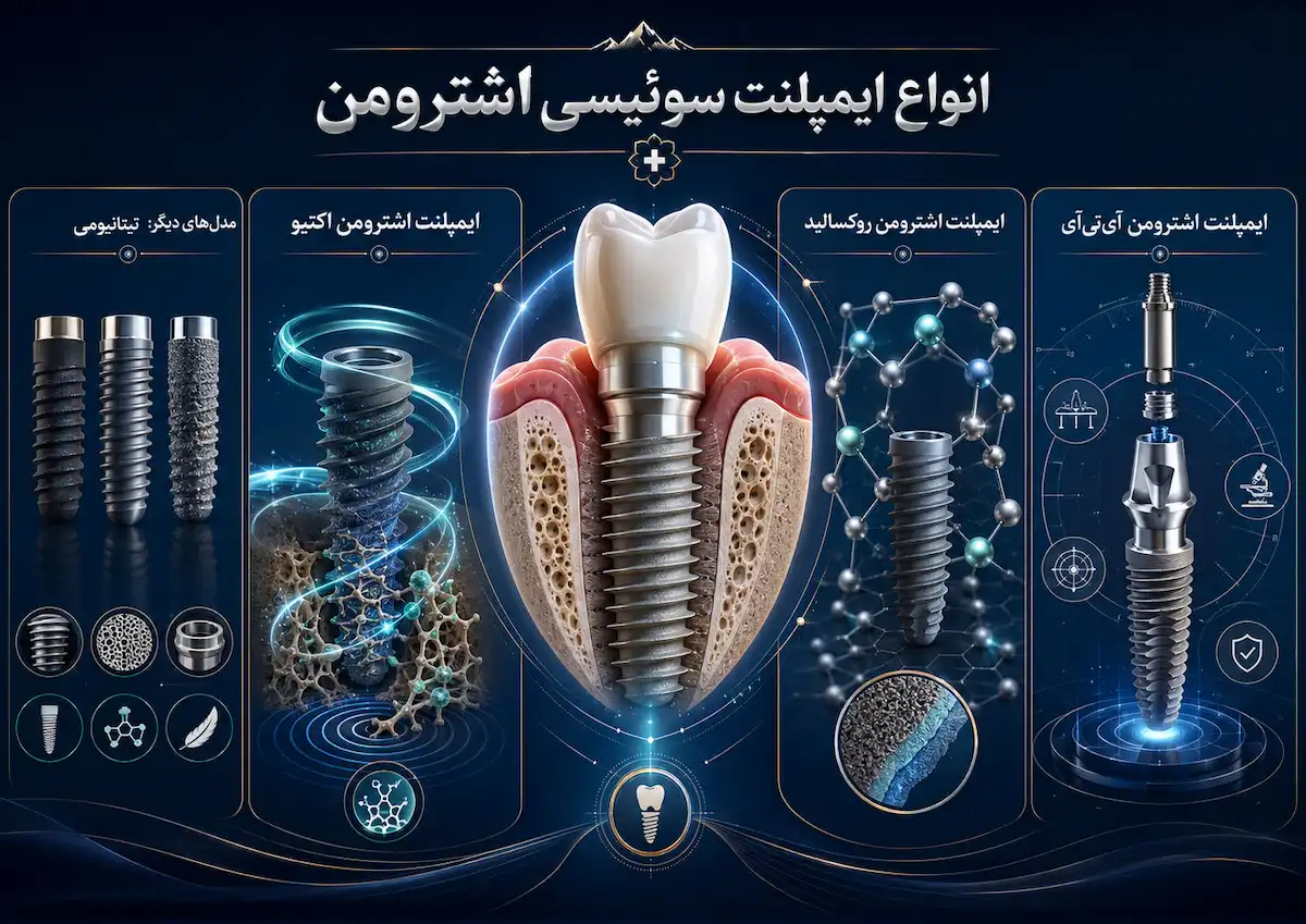 انواع ایمپلنت اشترومن straumann implant types