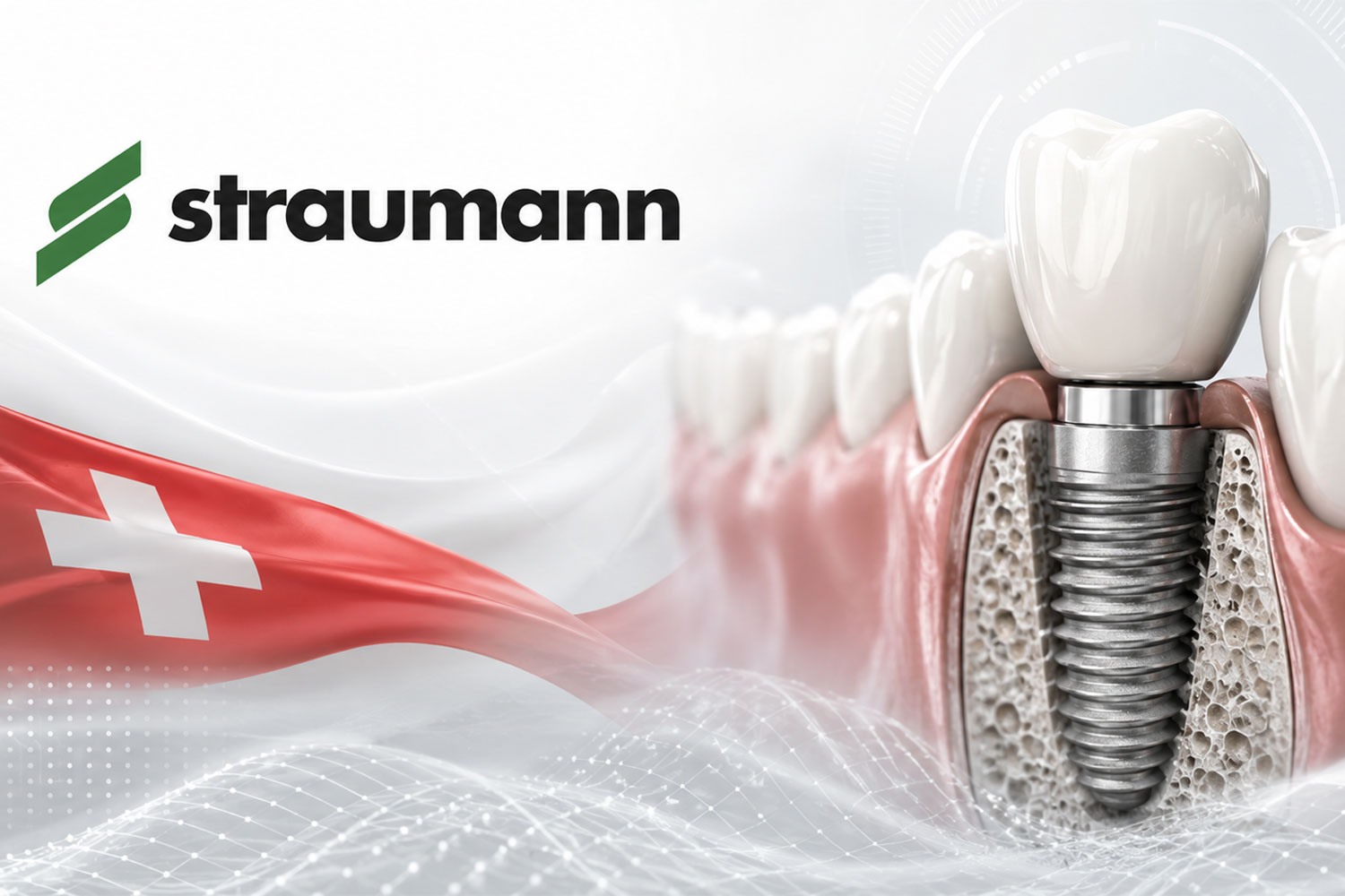 ایمپلنت اشترومن straumann implant