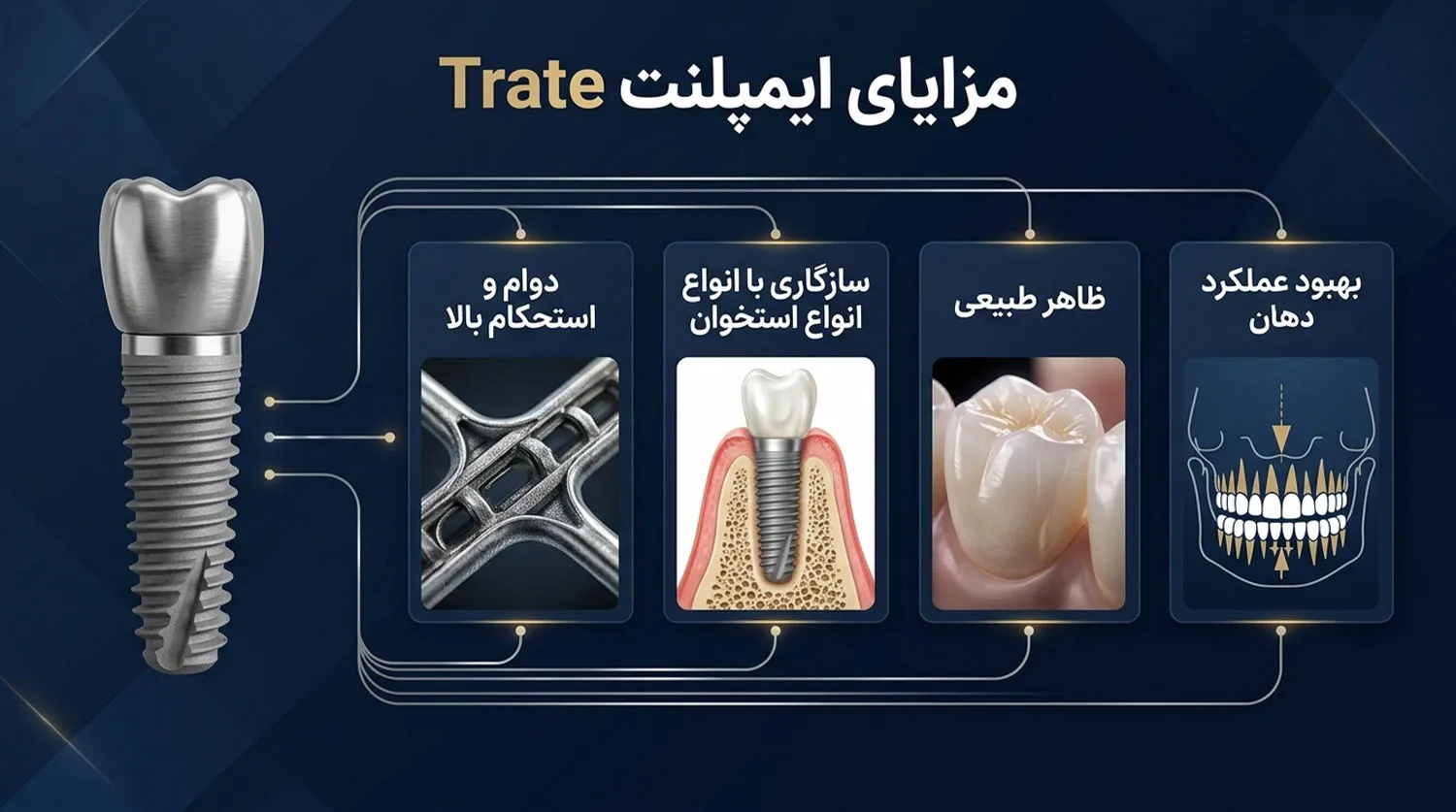 مزایای ایمپلنت تریت trate implant advantages