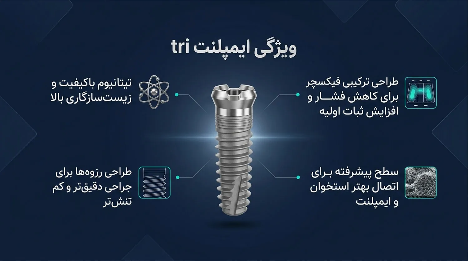 ویژگی ایمپلنت تی ار ای tri implant features