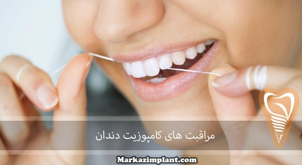 نخ دندان مناسب کامپوزیت دندان