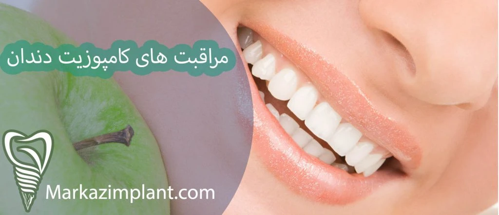 مراقبت کامپزویت دندان