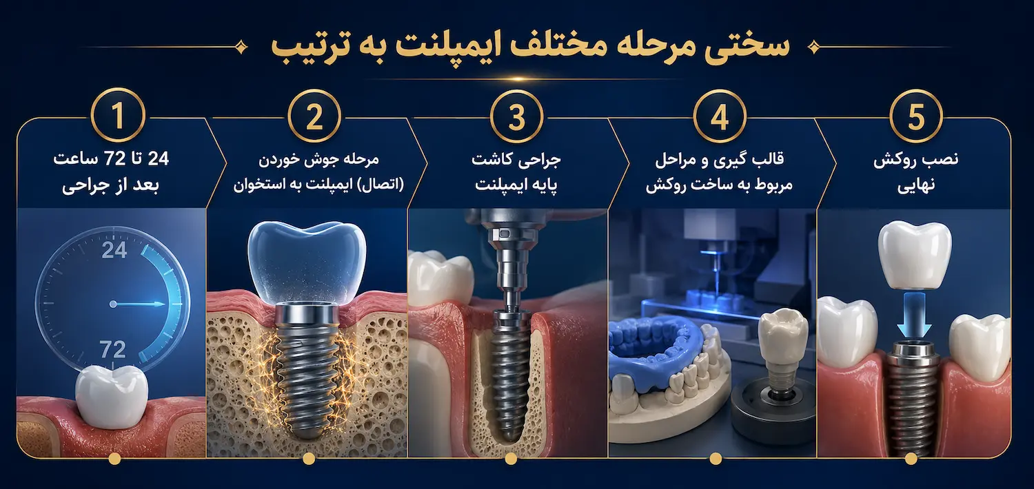 سخت ترین مراحل ایمپلنت به ترتیب