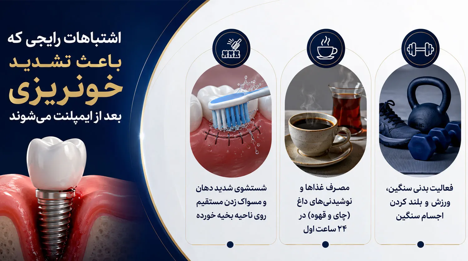 اشتباهات تشدید کننده خونریزی ایمپلنت دندان