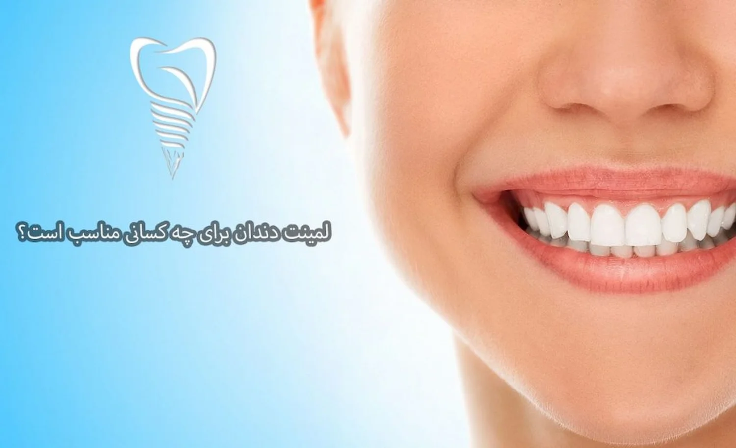 کاندیدای نصب لمینت دندان who is a good candidate for veneers