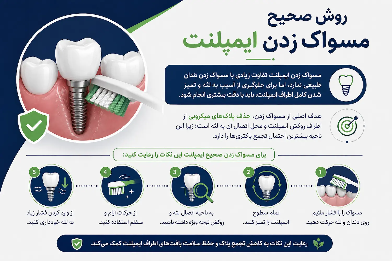 روش صحیح مسواک زدن ایمپلنت