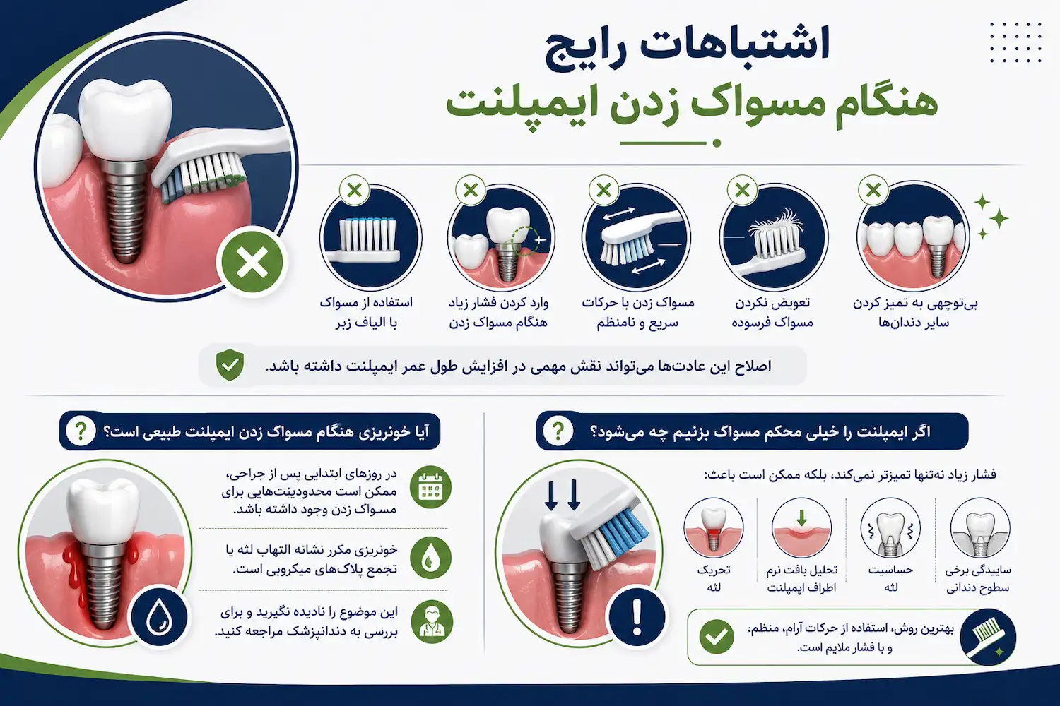 اشتباهات رایچ هنگام مسواک زدن ایمپلنت