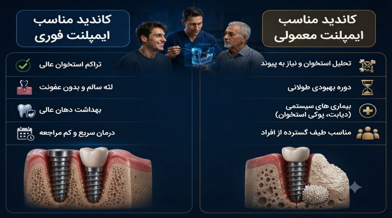 کاندیدای مناسب کاشت ایمپلنت فوری و معمولی