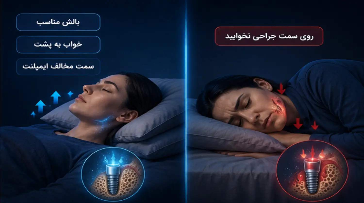 اشتباهات رایج خوابیدن روی ایمپلنت