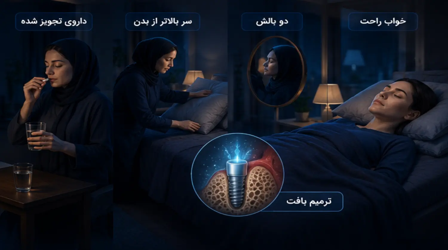 بهترین حالت خوابیدن بعد از ایمپلنت