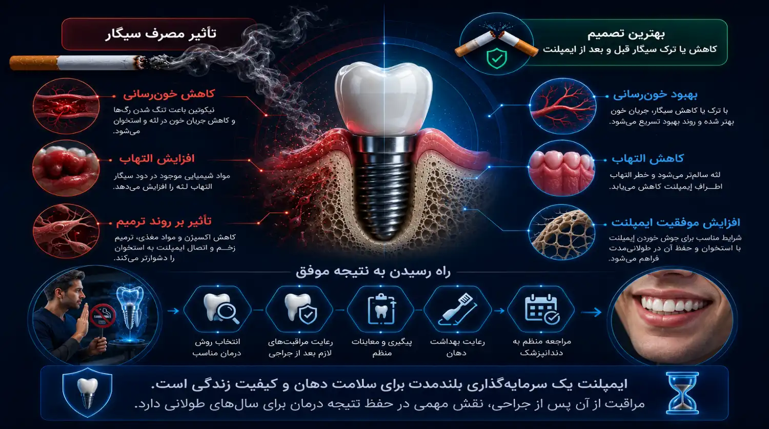 ایمپلنت دندان و سیگار