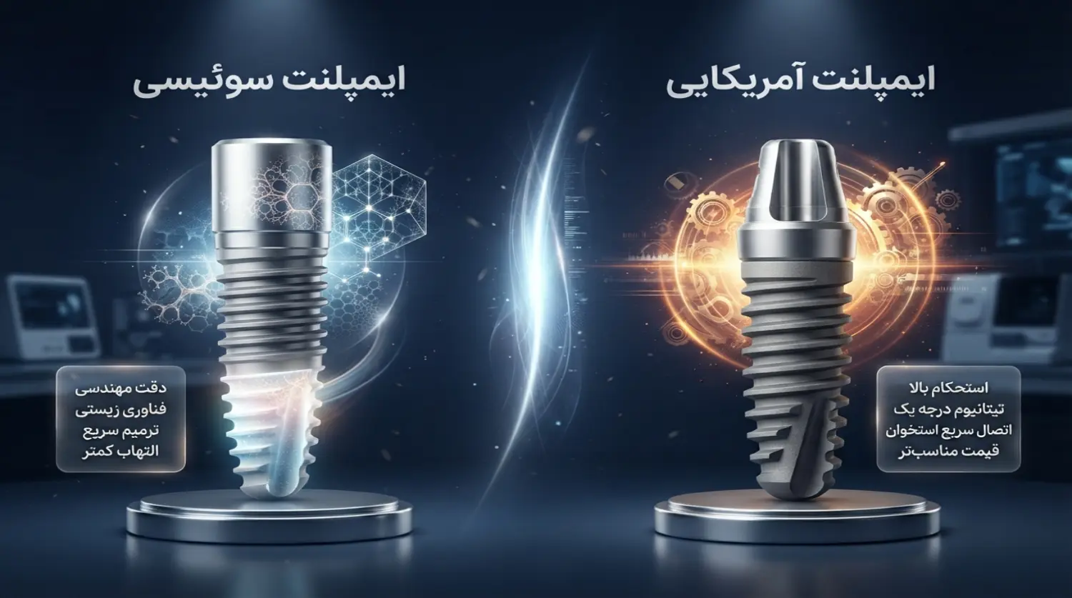 مقایسه ایمپلنت سوئیسی و آمریکایی