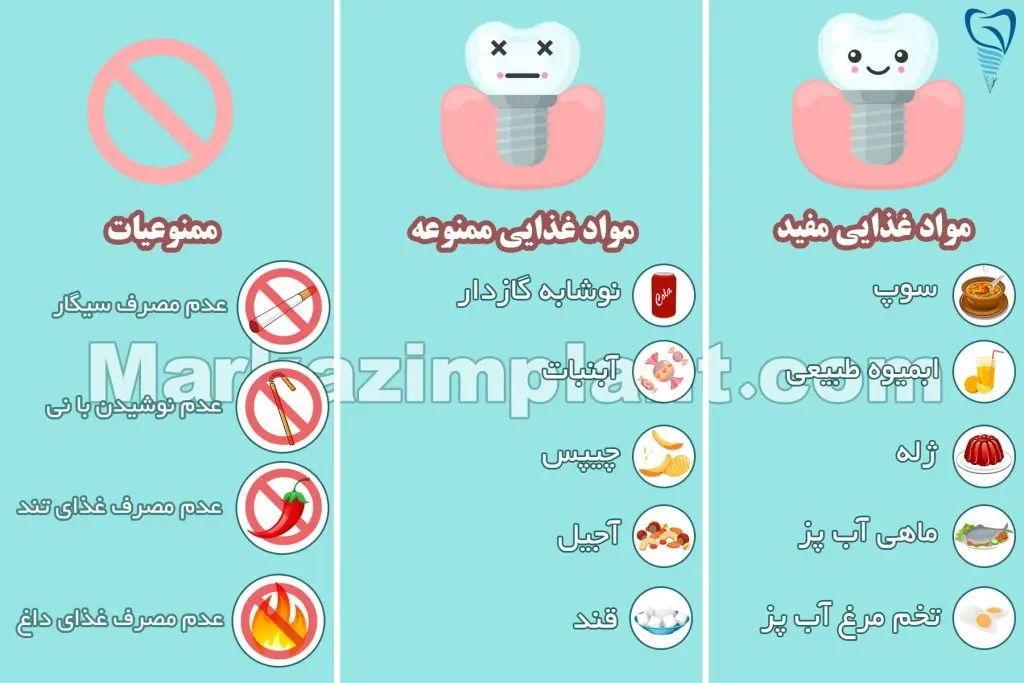 لیست تغذیه کامل بعد از ایمپلنت دندان
