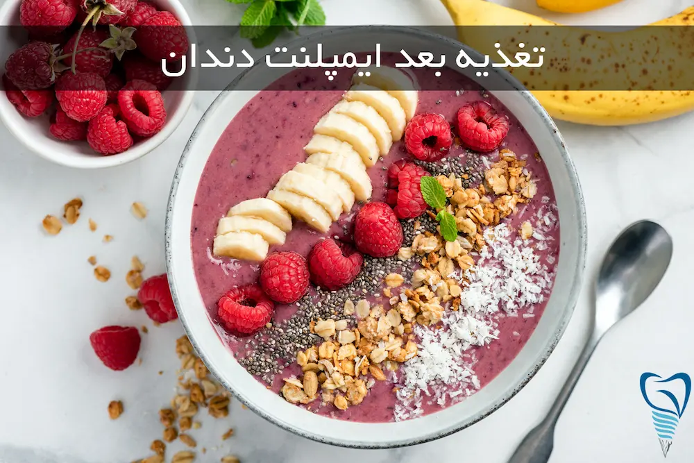 بعد از ایمپلنت چی بخوریم diet-after-dental-implants