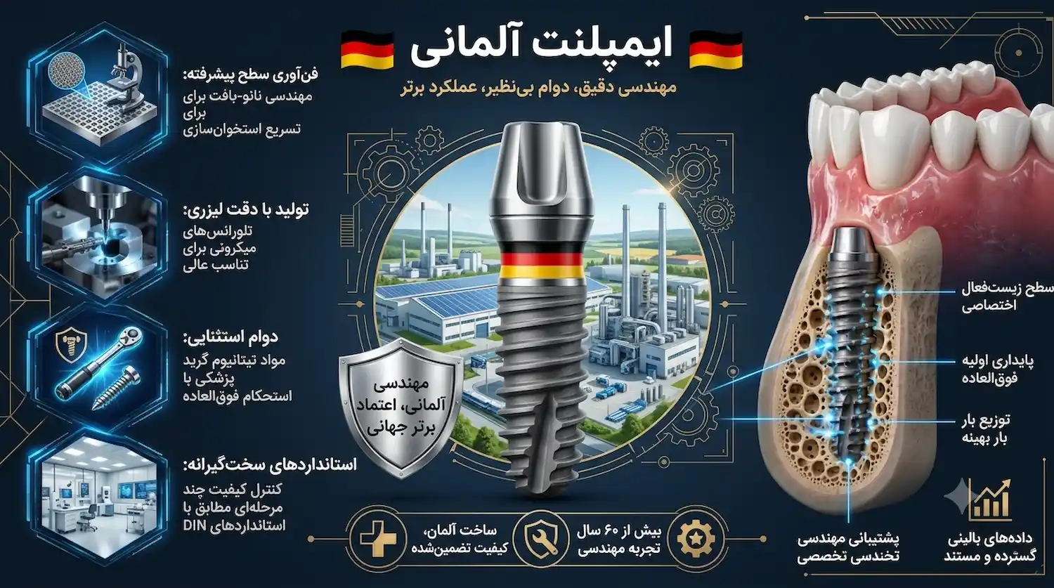 ویژگی های ایمپلنت آلمانی