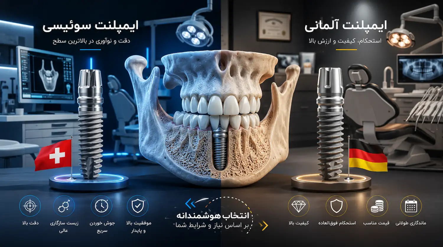 مقایسه ایمپلنت سوئیسی و آلمانی