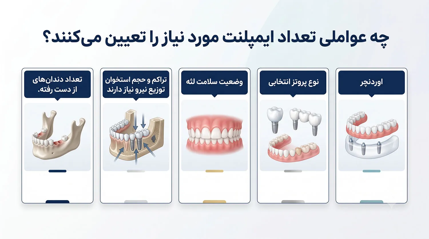 عوامل تعیین کننده تعداد ایمپلنت در هر فک