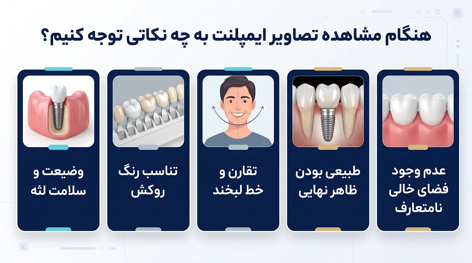 برای دیدن عکس ایمپلنت به چه نکاتی توجه کنیم