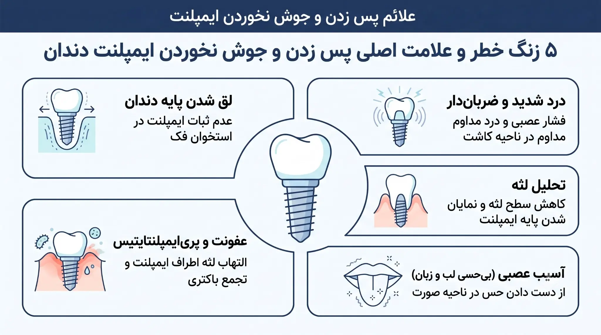 علائم علت پس زدن ایمپلنت دندان