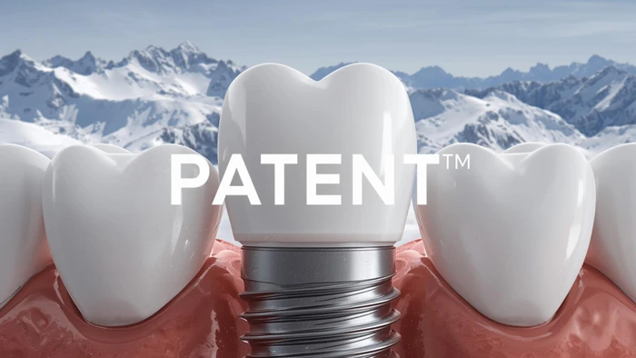 تاریخچه ایمپلنت patent