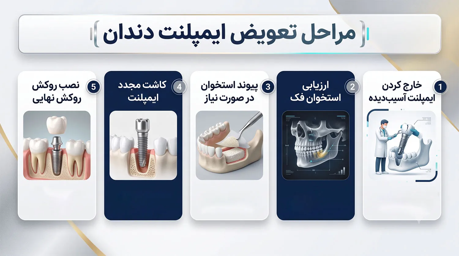 مراحل تعویض ایمپلنت دندان