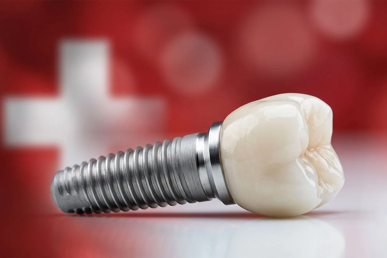ایمپلنت سوئیسی دندان swiss dental implant