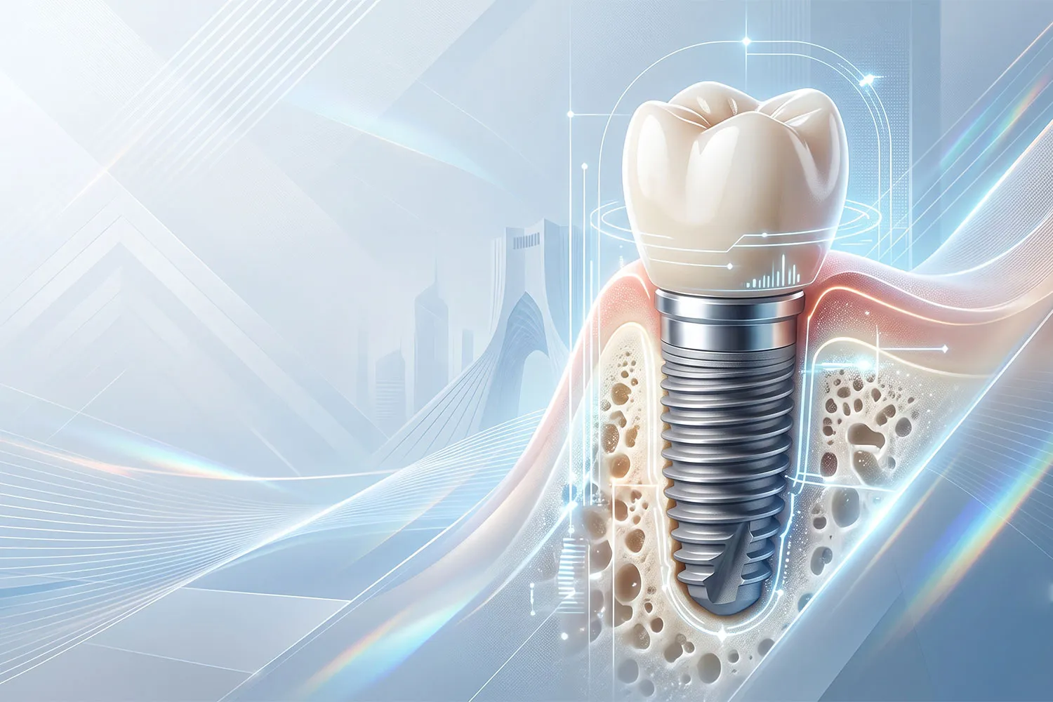 بهترین متخصص و مرکز ایمپلنت در تجریش tajrish best implant center