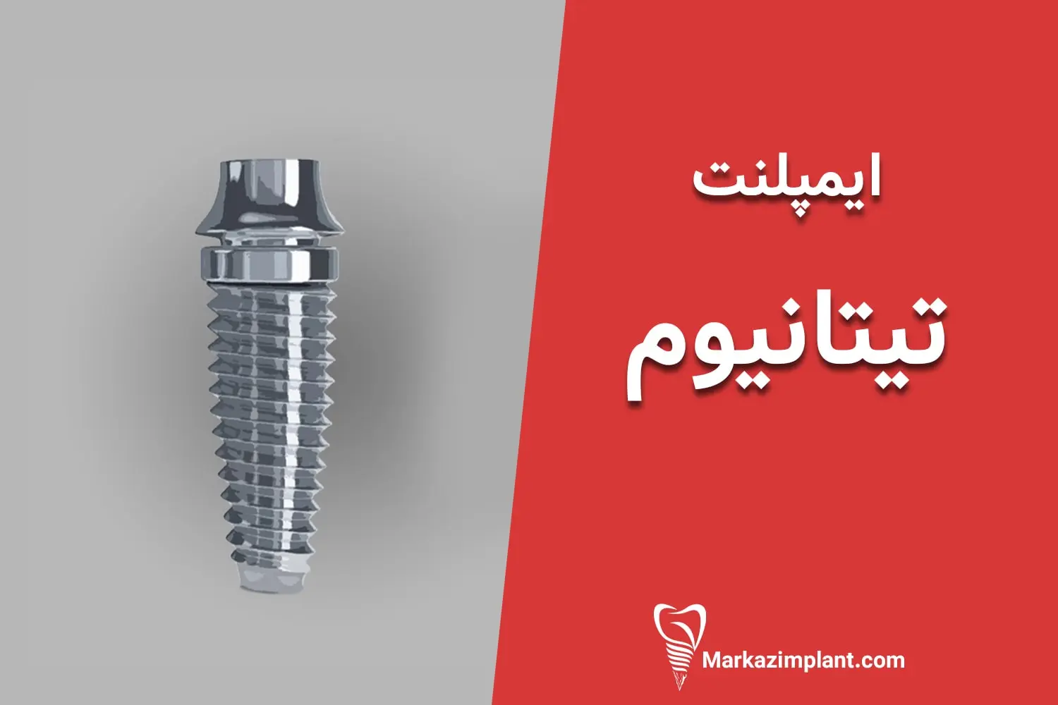 ایمپلنت تیتانیومی