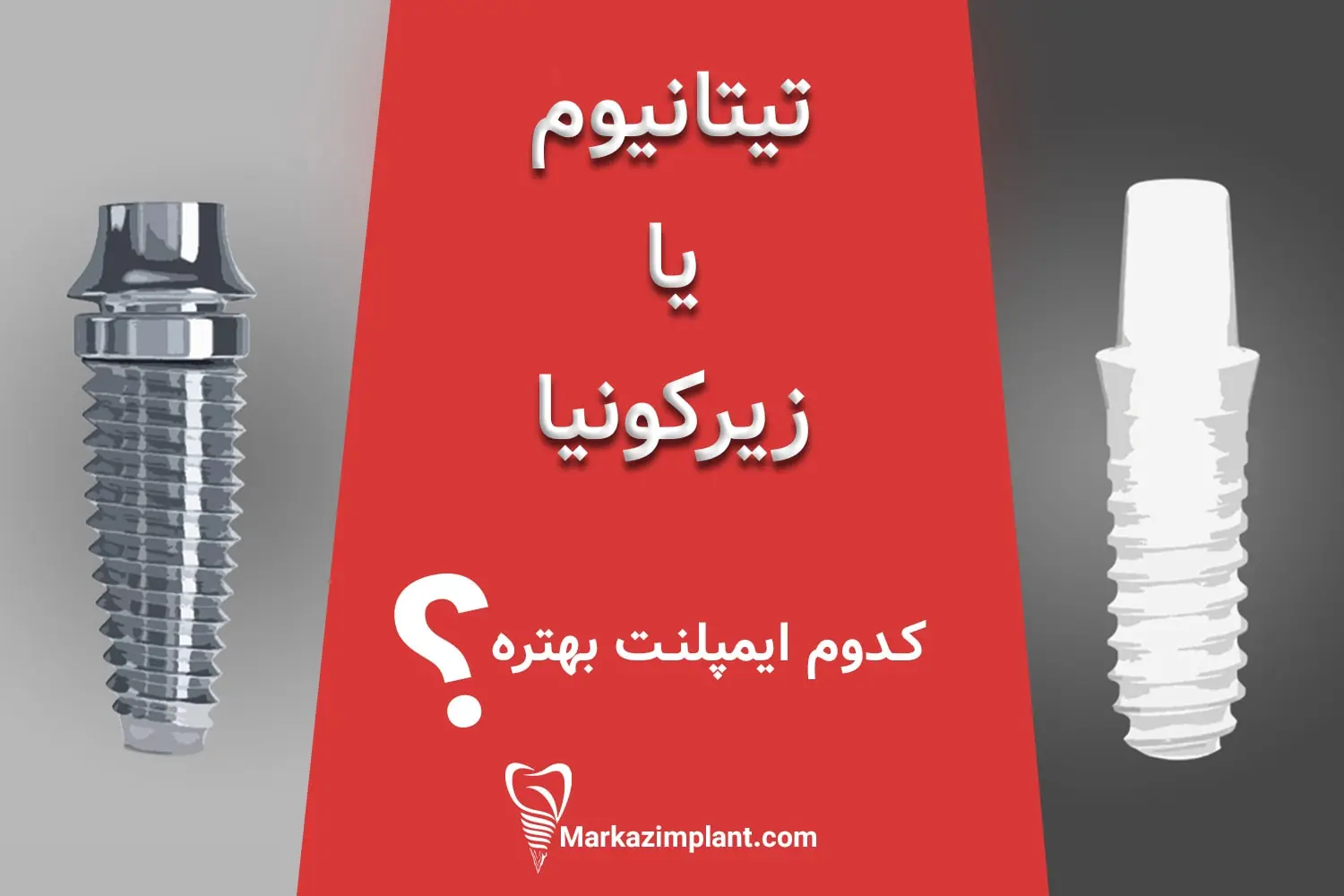مقایسه ایمپلنت زیرکونیا و تیتانیومی zirconia-vs-titanom-implant